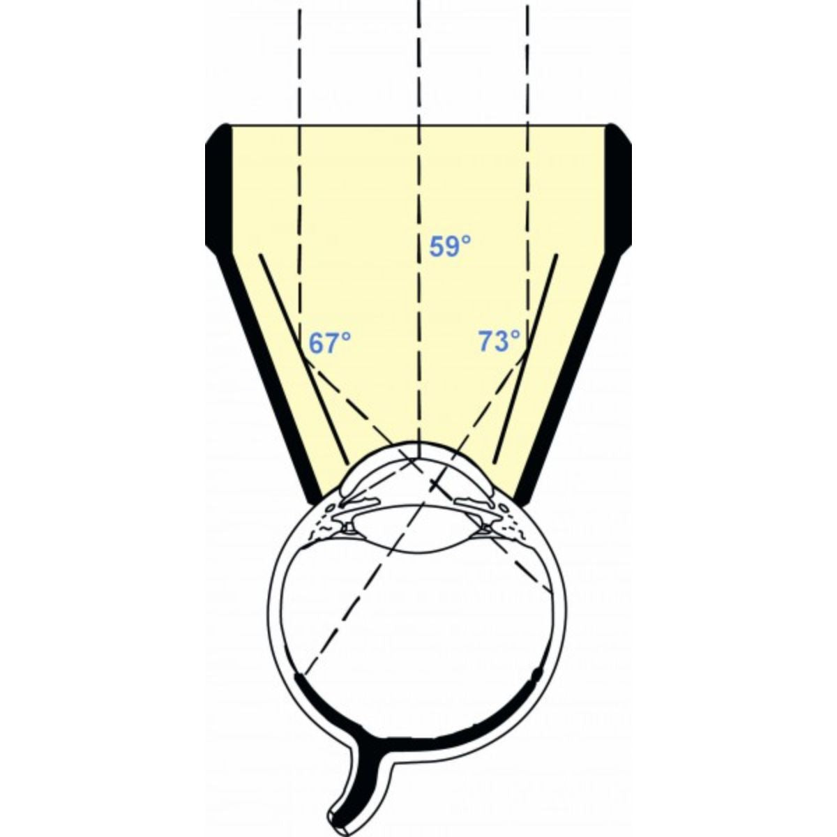 Lente de tres espejos tipo Goldmann, 17 mm, ángulos 59, 67 y 73
