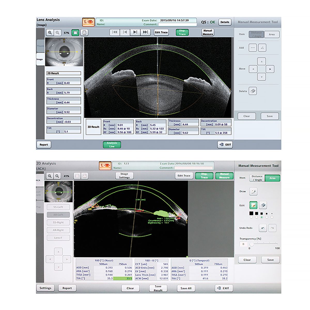 OCT SEGMENTO ANTERIOR CASIA 2