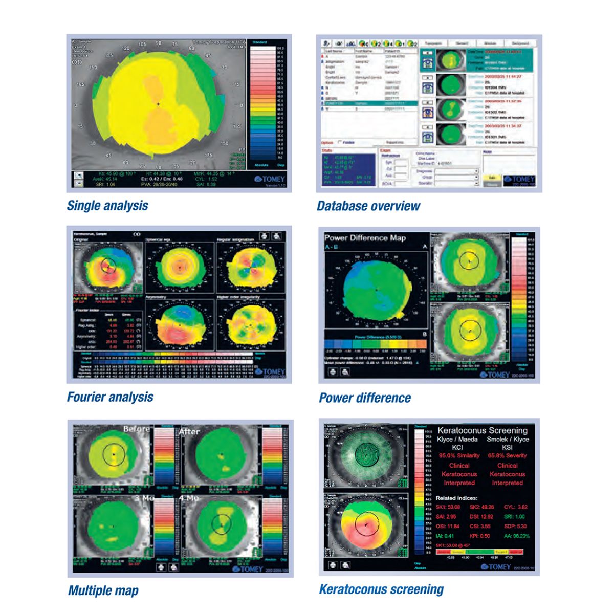 Topógrafo corneal TMS-4N con 31 conos, TOMEY