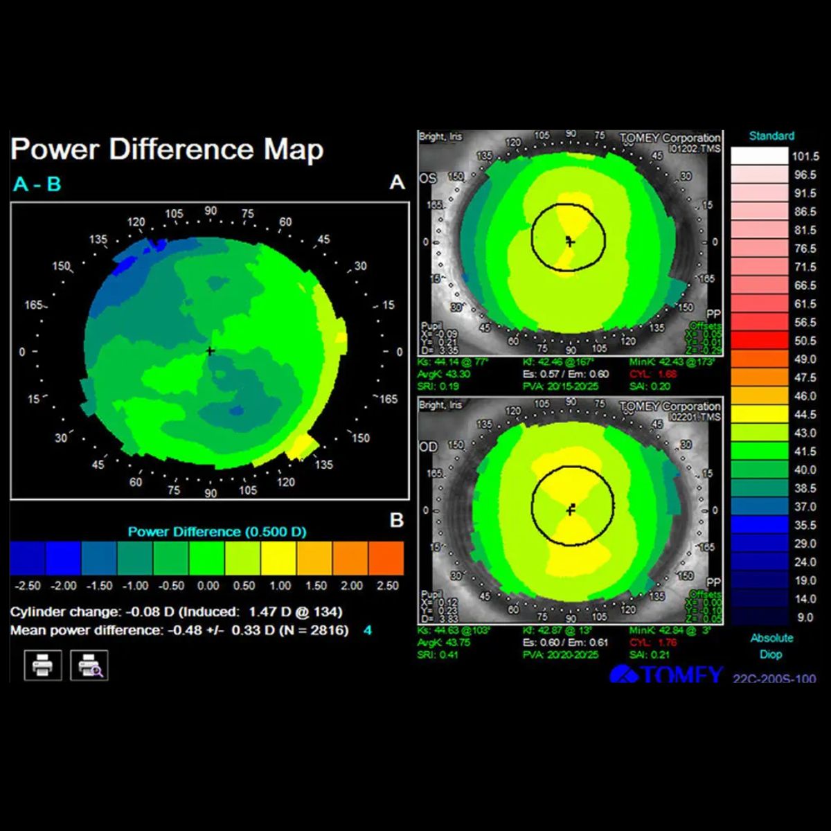 Topógrafo corneal TMS-4N con 31 conos, TOMEY