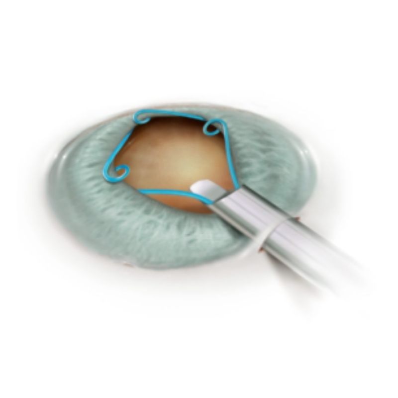 Anillo Malyugin Clásico 2.2, 7mm