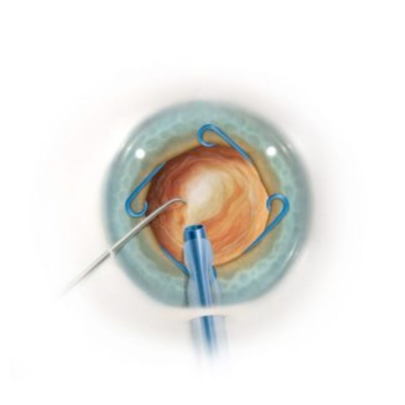 Anillo Malyugin Clásico 2.2, 7mm