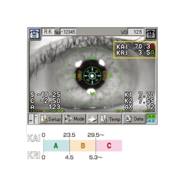 Autorefractor  Queratómetro  Topógrafo RT-7000 MARCA TOMEY