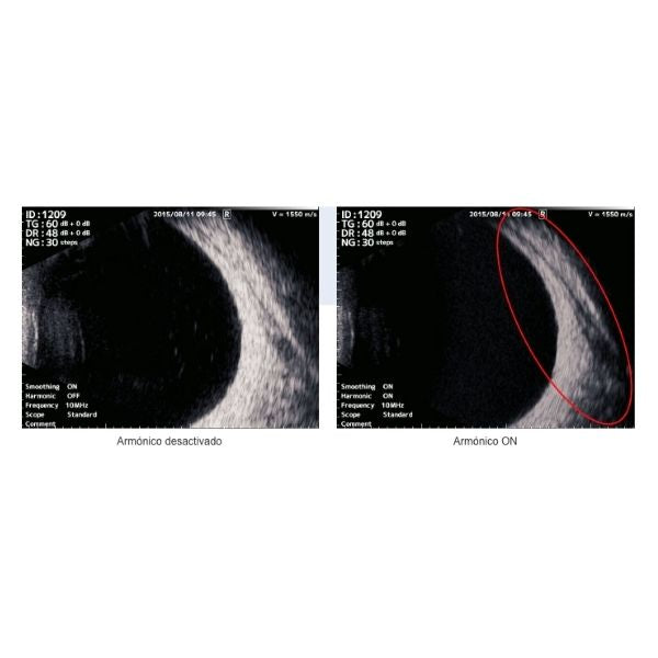 Ultrasonido modo A/B UD-800, TOMEY